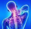 Understanding Cervical Spine Movement and Motor Vehicle Accidents