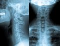 Defending the use of Routine X-Rays in Chiropractic Care: A Public Health Imperative