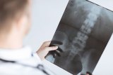 New Research Sheds Light on X-Ray Guidelines in Chiropractic
