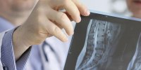 New Research on Importance of X-Rays in Chiropractic